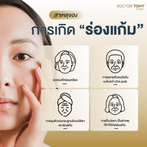 สารเหตุของการเกิดร่องแก้ม