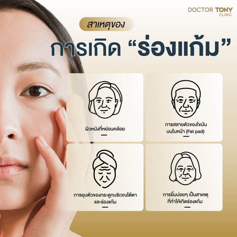สารเหตุของการเกิดร่องแก้ม