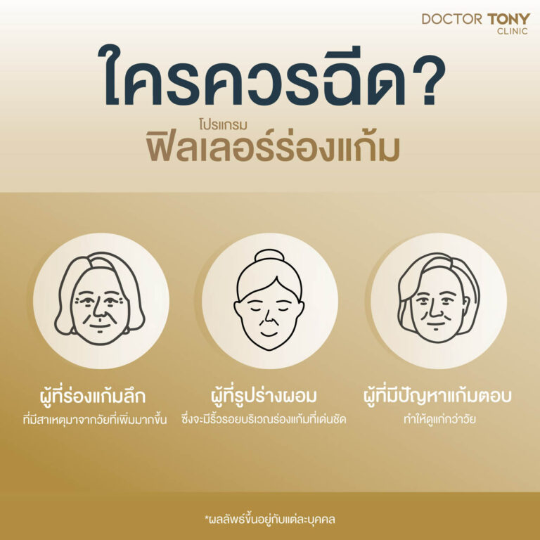 ใครควรฉีดฟิลเลอร์ร่องแก้ม