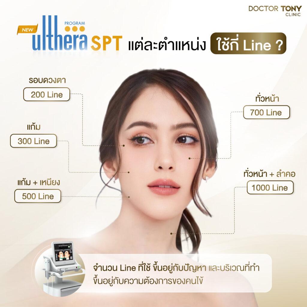ulthera-ใช้กี่-line