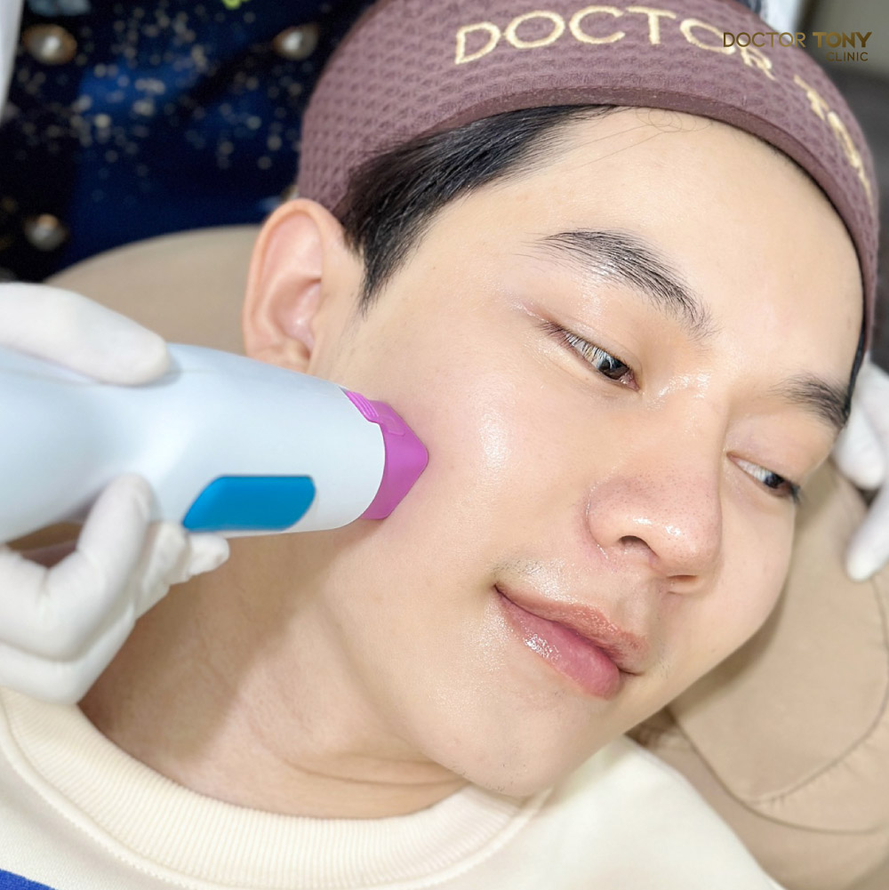 thermage แก้ม