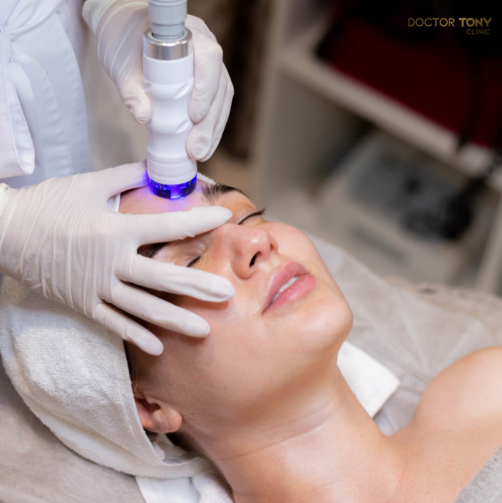 รักษาฝ้า ด้วยการทำทรีตเม้นท์