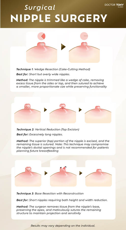 nipple surgery