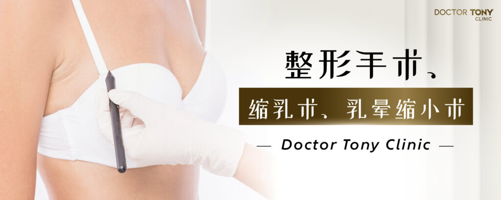 乳晕缩小整形术