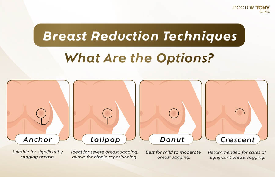 breast reduction techiques