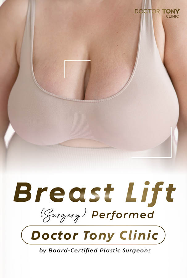 breast lift surgery
