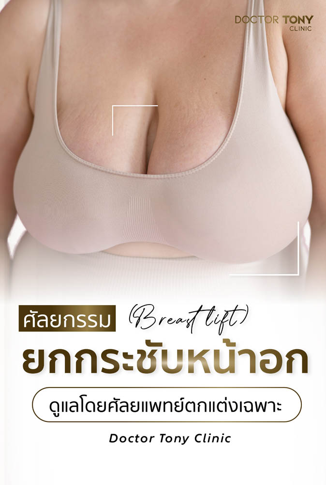 ยกกระชับหน้าอก (breast lift)