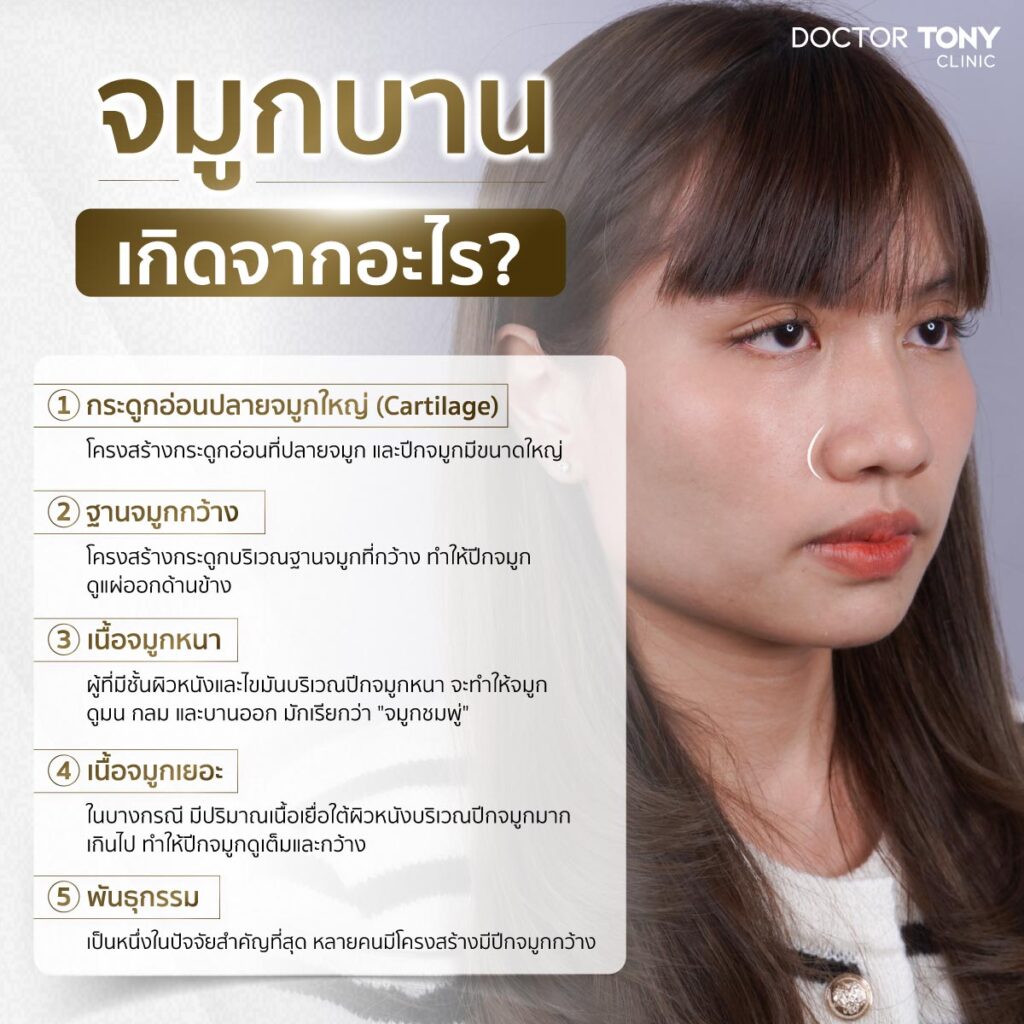 จมูกบาน เกิดจากอะไร