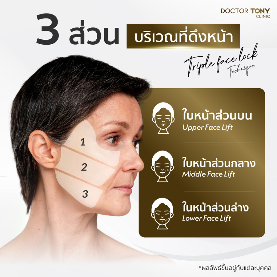 ดึงหน้าส่วนไหนได้บ้าง?