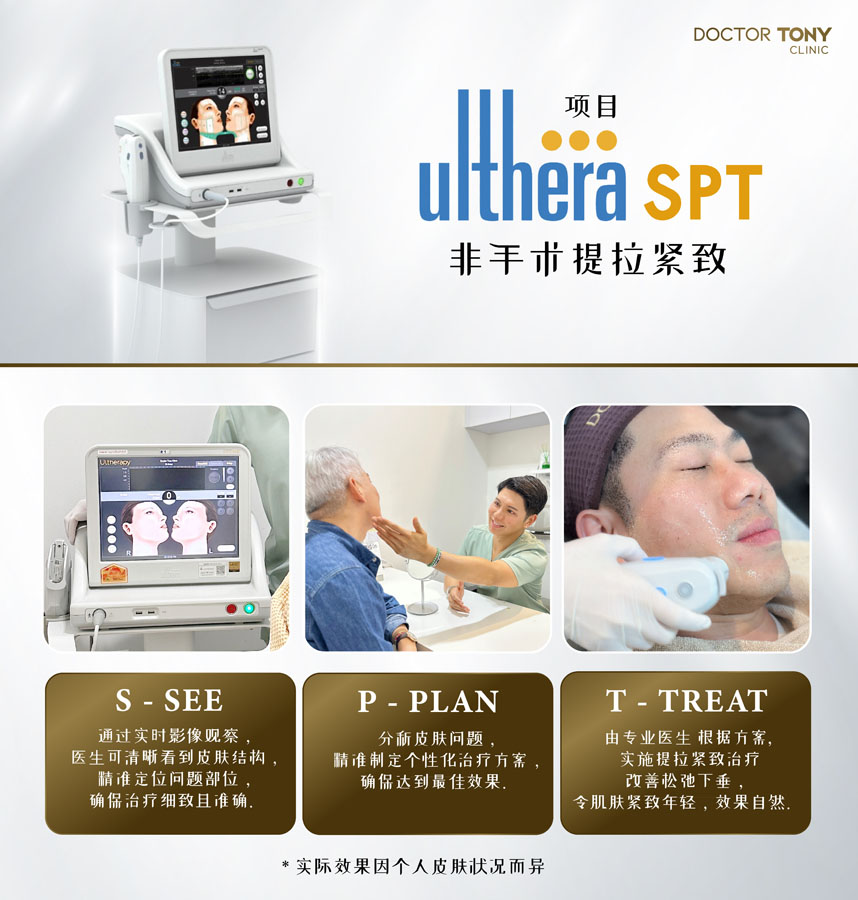 ultherapy SPT 2