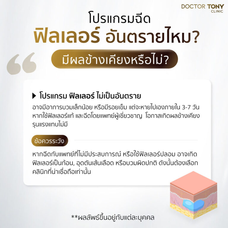 ฟิลเลอร์อันตรายไหม