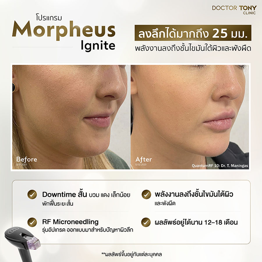 รีวิว Morpheus ignite 13