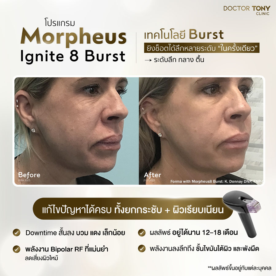 รีวิว Morpheus ignite 30