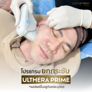 เต้ นันทศัย ทำ Ulthera 2