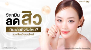 วิตามินลดสิว
