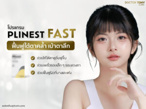 Plinest fast cover