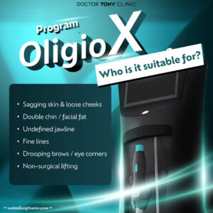 OligioX