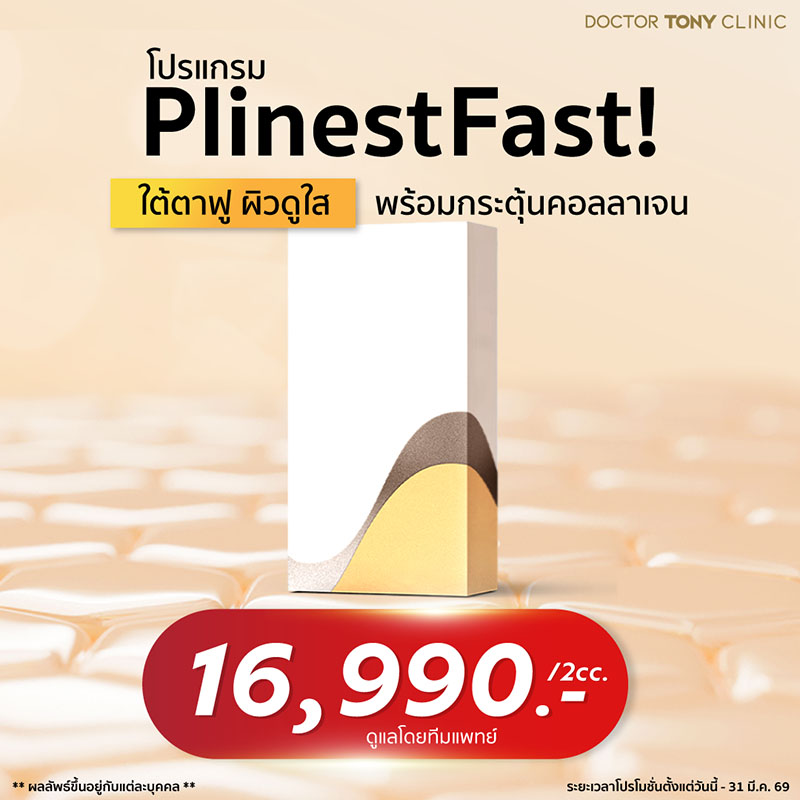 Plinest Fast promotion 1