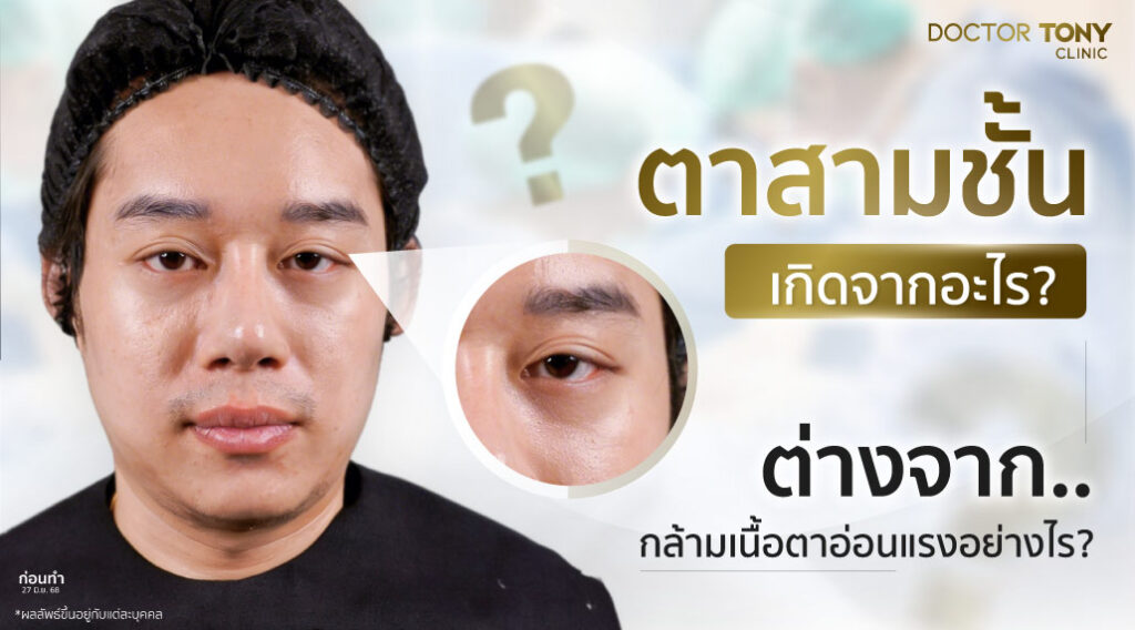 ตาสามชั้น