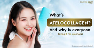 atelocollagen