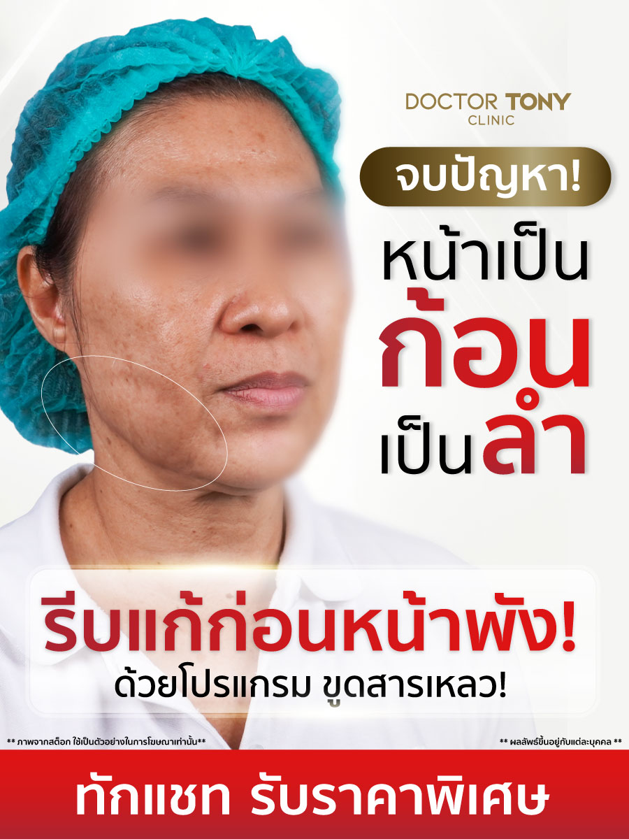 ขูดสารเหลว