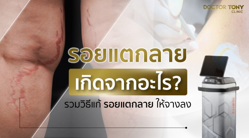 รอยแตกลาย