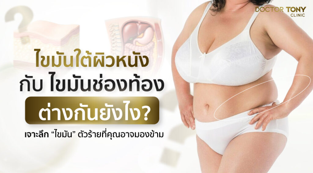 ไขมันใต้ผิวหนัง